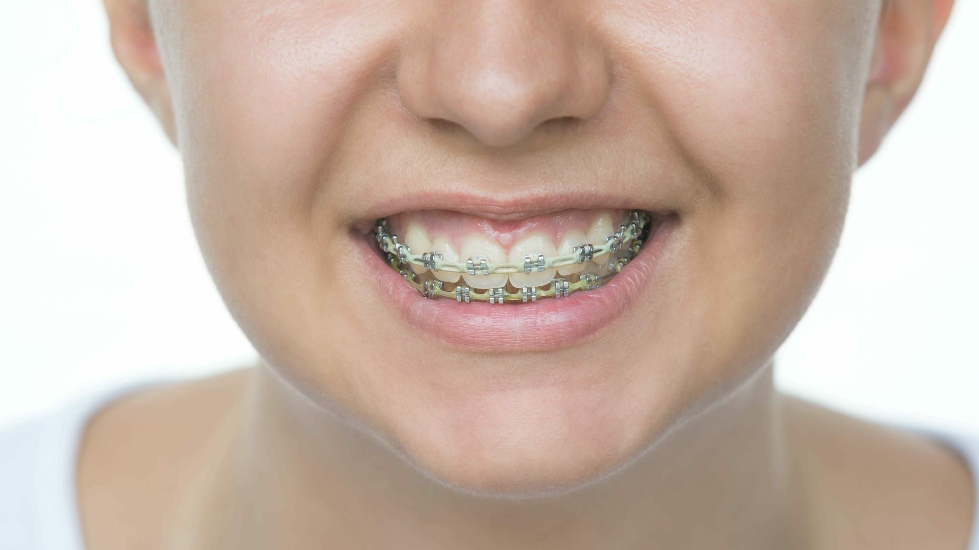 Orthodontics • SA Dental